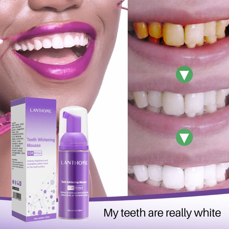 Diş Beyazlatmak Renk Düzeltici Lekeleri Kaldırır Diş Beyazlatmak Ağız Hijyeni Diş Macunu Beyazlatmak Boyama Görüntü 2