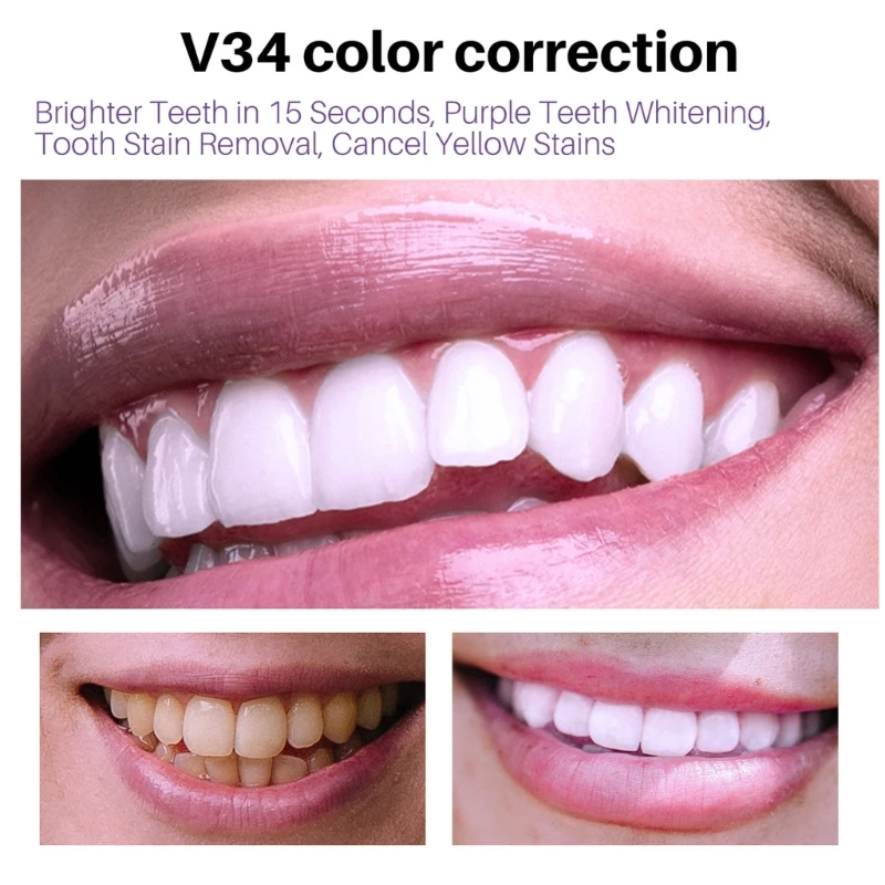 Diş Beyazlatmak Renk Düzeltici Lekeleri Kaldırır Diş Beyazlatmak Ağız Hijyeni Diş Macunu Beyazlatmak Boyama Görüntü 4