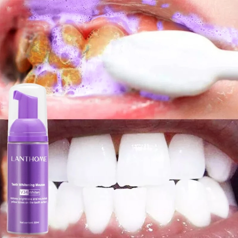Diş Beyazlatmak Renk Düzeltici Lekeleri Kaldırır Diş Beyazlatmak Ağız Hijyeni Diş Macunu Beyazlatmak Boyama Görüntü 5